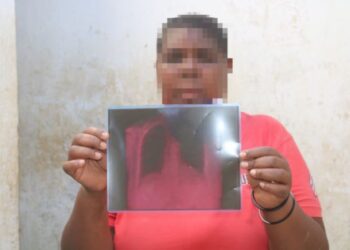 Shocking! Man Allegedly Breaks Wife’s Ribs While Trying To Forcefully Circumcise Her Using Pliers