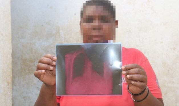 Shocking! Man Allegedly Breaks Wife’s Ribs While Trying To Forcefully Circumcise Her Using Pliers
