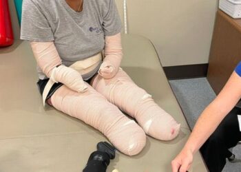 Mother Of Three Forced To Have Hands And Feet Amputated After Getting Covid19