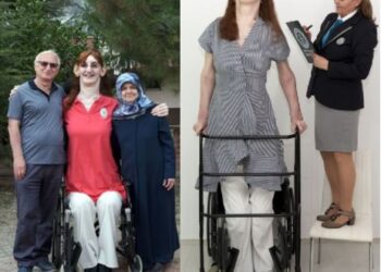 Meet The 24-year-old Lady Crowned By Guinness World Records As The Tallest Woman In The World (Photo)