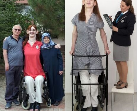 Meet The 24-year-old Lady Crowned By Guinness World Records As The Tallest Woman In The World (Photo)
