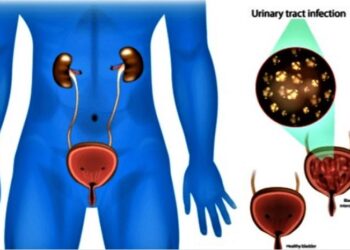 Why More Older Men Are Suffering From Urinary Tract Infections – Expert Reveals