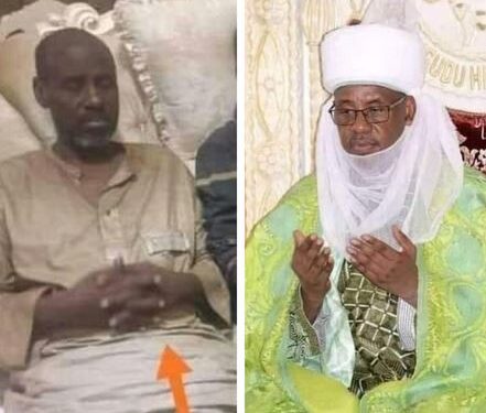 SAD! See How Emir Of Bungudu Looks Like A Shadow Of His Former Self After 32 Days In Bandits Den (‘Before & After’ Photos)