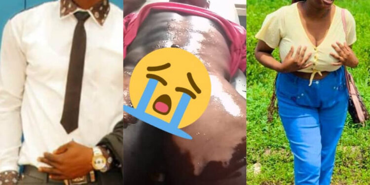 FUTO Student Arrested For Scalding Fellow Student With Hot Water Over Toothpaste
