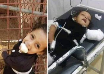 So Sad: 2-Year-Old Girl Lost Her Hand To Lion’s Bite Inside A Zoo