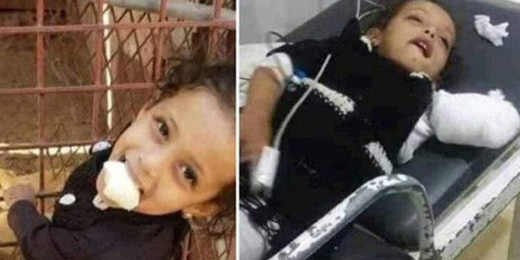 So Sad: 2-Year-Old Girl Lost Her Hand To Lion’s Bite Inside A Zoo
