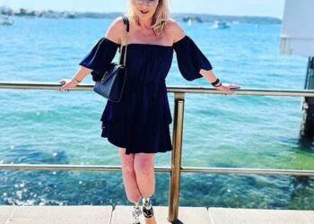 After 32 Surgeries, Australian Woman Has Both Legs Amputated After Mosquito Bite In Nigeria