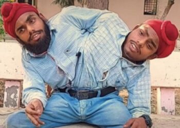 Excitement As Conjoined Twins Abandoned By Their Parents Land First Jobs With Two Salaries