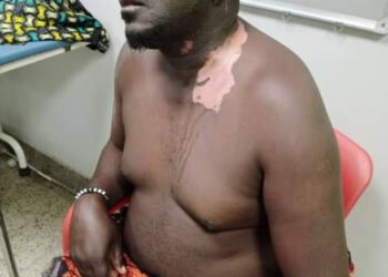 Woman Pours Hot Cooking Oil On Her Husband (Graphic Photos)