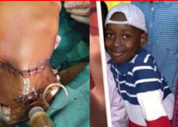See Photos Of 11-Year-Old Boy Whose Throat Was Slit By SS2 Student In Borno (Viewers Discretion)