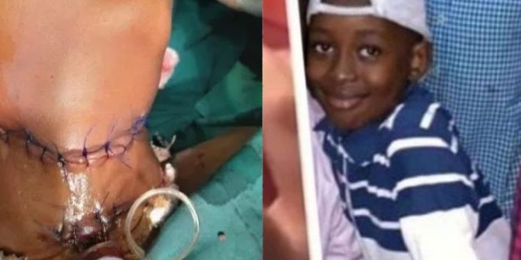 See Photos Of 11-Year-Old Boy Whose Throat Was Slit By SS2 Student In Borno (Viewers Discretion)