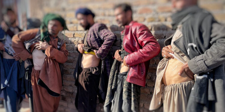Afghans Now Selling Their Kidneys To Survive Under Taliban Rule