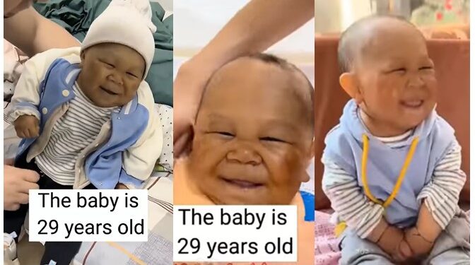 Meet 29-year-old ‘Baby’ Who Can’t Grow Due To Rare Medical Condition (Photos & Video)