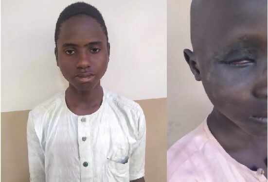17-year-old Nigerian Boy Arrested For Gouging Out Eyeball Of 12-year-old Almajiri To Prepare Disappearing Charm (Photos)