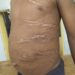 See The Unbelievable Photos Of 8-Year-Old Boy Who Was Gruesomely Tortured By His Teacher In Kano