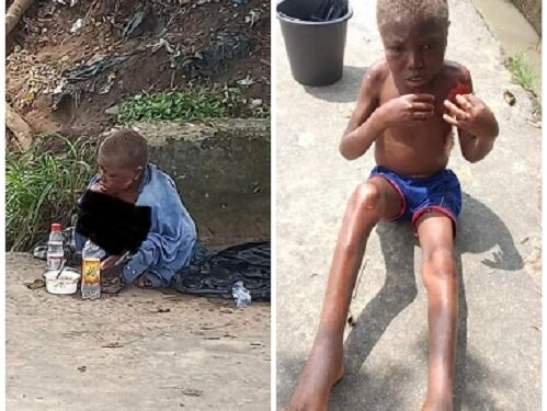 Little Boy Branded A Witch And Abandoned On Streets Of Uyo (Graphic Photos)