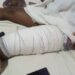 I Have Been Bedridden Since Herdsmen Attacked, Matcheted Me – Osun Resident, Abiodun Cries Out