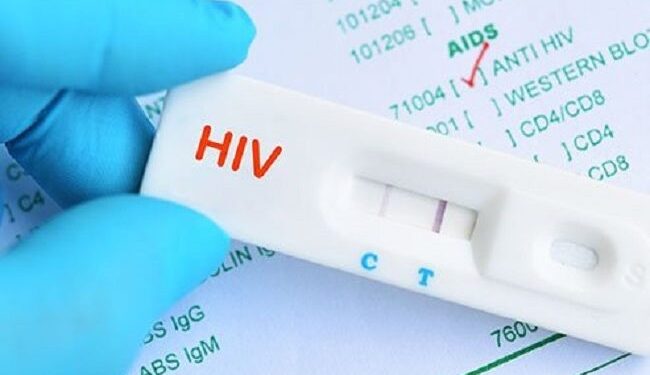 Taraba Govt Begins Mass Testing For HIV As 77 Persons Are Confirmed Positive