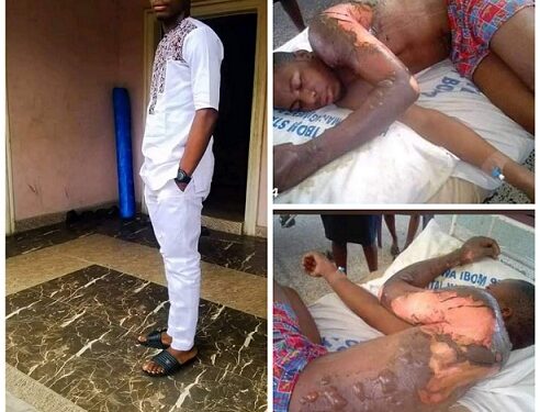 Roadside Petrol Dealer Allegedly Sets Varsity Student Ablaze In Akwa Ibom (Photos)