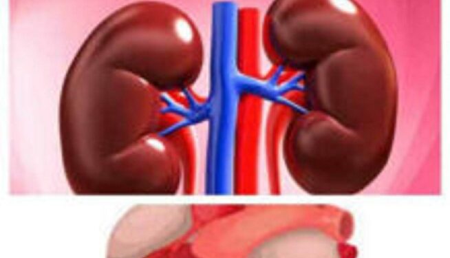 A Kidney Now Costs $262,000; Heart, $119,000 – UN Warns Nigerians!