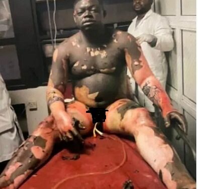 Tragedy As Wife Sets Husband Ablaze In Osogbo (Photos)