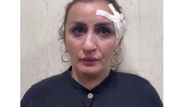 Mum Accused Of Selling Her Five-day-old Baby Boy For £3,000 To Pay For Nose Job (Photos)