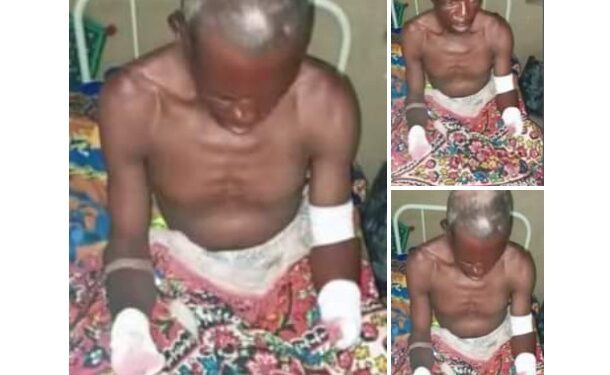 Tragedy As Bandits Chop Off Man’s Hands In Zamfara (Photos)