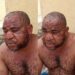 Nigerian Man Suffering From Monkey Pox Narrates How He Was Misdiagnosed By Multiple Doctors As He Opens Up About The Ailment (Video)