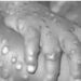 Nigeria now has 241 cases of monkeypox, Lassa fever 909 – NCDC