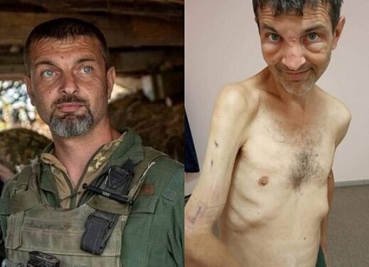 See Shocking Before And After Photos Of Ukranian Soldier Recently Released In Prisoner Swap After Four Months In Russian Captivity (Pictures)