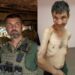 See Shocking Before And After Photos Of Ukranian Soldier Recently Released In Prisoner Swap After Four Months In Russian Captivity (Pictures)