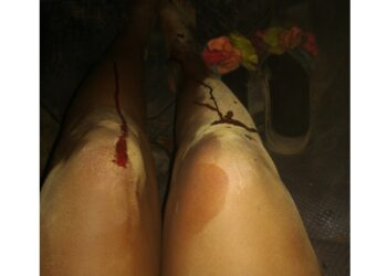 “I’m Not OK” – Woman Suffers Injuries While Trying To Outrun Two Rap*sts