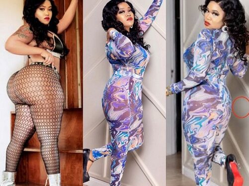 “I Was Given A Second Chance” – Vera Sidika Begs Women To Avoid Cosmetic Surgery, Shares Video From Her Reconstructive Surgery Experience