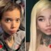 IG Model Who Is HIV Positive Is Now Blind After Eye Surgery