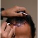 Bald Television Executive Dies After His Organs Collapsed Due To Dodgy Hair Transplant (Photos)