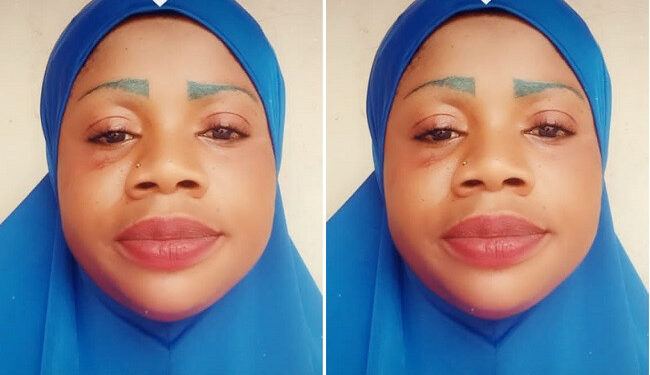 Nurse Arrested In Ogun For Allegedly Injecting 22-year-old Graduate In The Nerve, Causing Permanent Disability to His Leg (Photo)