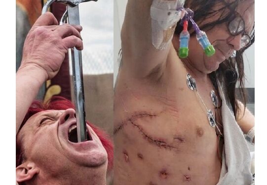 Legendary Sword Swallower Pierces His Abdomen, Liver And Loses Part Of His Lung During Practice (Photos)