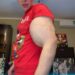 Meet The Bodybuilder Who Injected Oil Into Biceps To Make Them Big (Photos)
