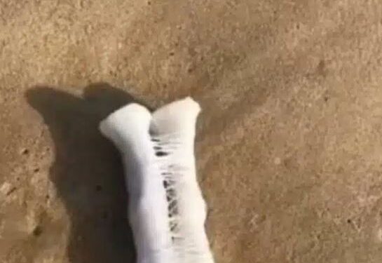 Lady Shares Photo Of Strange Object She Found At The Beach