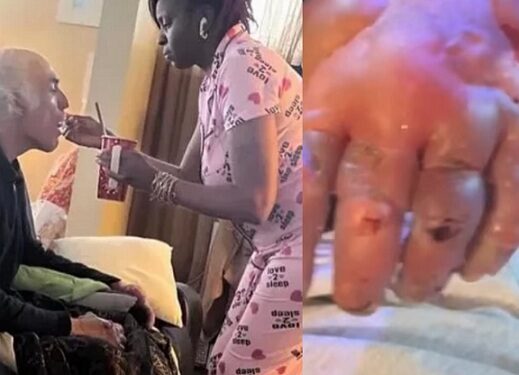 Mentally Unstable Man Who Was Saved By Kind Hearted Stranger During Snow Blizzard Loses All His Fingers To Frostbite (Photos)