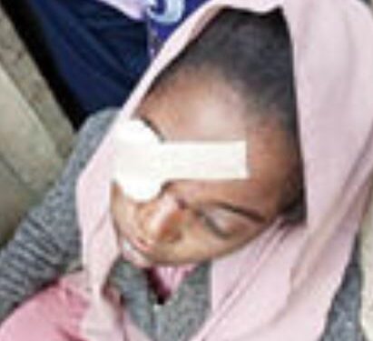 Bride Suffers Injury In Her Eye After Vigilante Members Allegedly Disrupted Her Wedding Party In Kano
