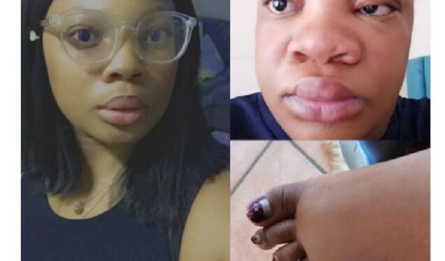 Man Shares Photos Showing The Physical Transformation His Friend Experienced During Pregnancy