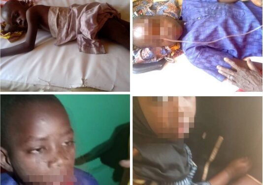 #NigeriaElections2023: Photos Of Children Injured As Terrorists Attack Voters In Borno Community