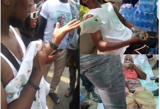 See Peter Obi’s Supporters Who Were Attacked With Machetes While Waiting for Their Presidential Candidate’s Arrival At TBS Lagos (Photos & Videos)