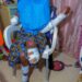 17-Year-Old Nigerian Girl Forced Into Marriage Loses Hand And Leg After Her Husband Attacked Her With a Machete (Photos)