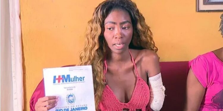 Confusion As Samba Dancer Goes In For Surgery On Uterine Fibroids But Wakes Up With Her Arm Amputated (Photos)