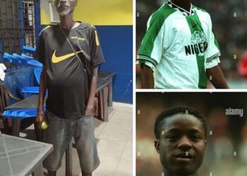 Ex-Super Eagles Star, Emmanuel Ebiede Down With Hepatitis And Swollen Stomach (Photos)
