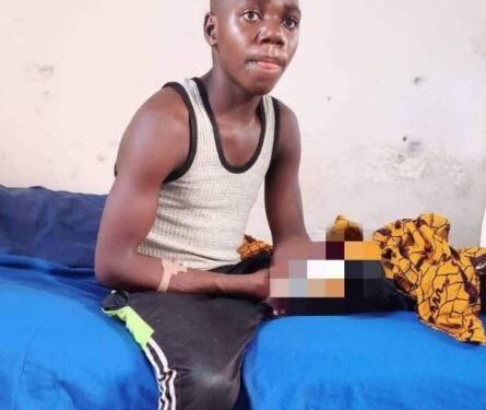 19-Year-Old Boy Recounts His Ordeal As Bandits Cut Off His Arm Despite Paying Ransom