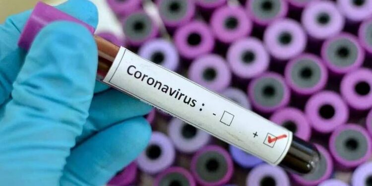 COVID-19 Is No Longer A Global Health Emergency – WHO Declares