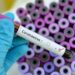 COVID-19 Is No Longer A Global Health Emergency – WHO Declares